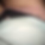  - 1
